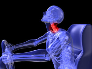 Car Accident Lawyer Marietta, GA - 3d illustration of driver neck injury