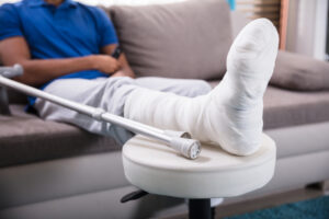 Understanding Personal Injury Practice Areas - Man's Broken Leg